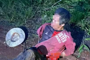 Đắk Lắk: Điều tra vụ người đàn ông bị tấn công bằng đá, nguy kịch