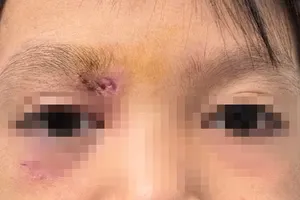 Bệnh nhi đã qua cơn nguy hiểm