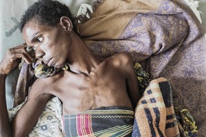 非洲愛滋病死亡數字居高不下。圖源：互聯網