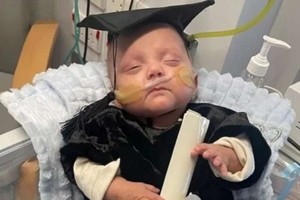 盧卡斯健康出院。