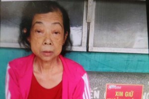 張玉容正在7A軍醫醫院接受醫治。