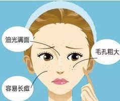 ４種膚質很常見