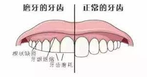 睡覺磨牙是什麼原因？