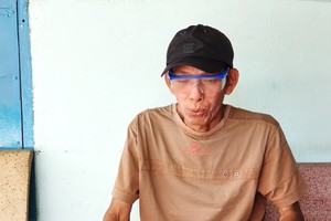 郭明倫的雙眼近乎看不見了。