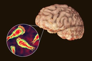 （示意圖源：互聯網）