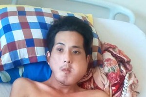 謝弟光的臉及腋下的腫瘤日益變大。