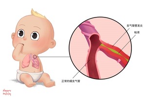 （示意圖源：互聯網）