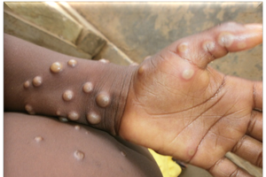 （示意圖源：互聯網）