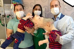 以 VR 成功分割頭部連體雙胞胎