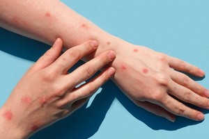 （示意圖源：互聯網）