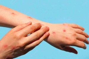 （示意圖源：互聯網）