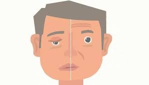 ５原因可能致嘴臉歪