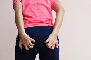 坐硬椅子小心这种“皮肤病”