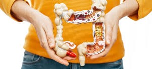 年轻人须警惕４种“肠炎”症状