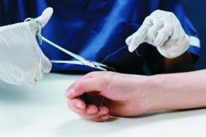 ３种常见缝合方式