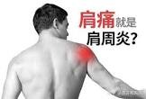 ４种情况可了解不一定是肩周炎