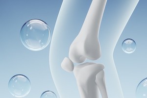 不只女性，男性骨松藏危机，下背痛小心