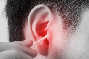 掏耳后“耳朵发臭流汤”听力受损30分贝