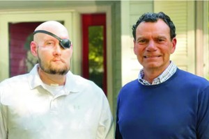 首例人类全眼移植手术完成