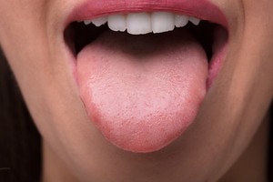 从舌头看身体健康状况