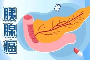 腹痛、恶心是读懂胰腺求救信号