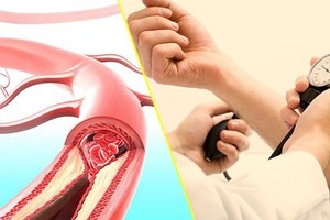 了解高血压信号，并及时干预，可以让血压恢复平稳状态。