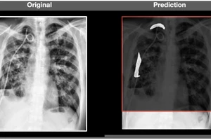 Hình ảnh được chẩn đoán bằng công cụ AI do FPT Software phát triển