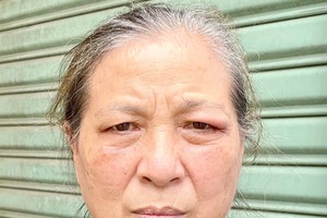 贫困癌症妇女求助以就医