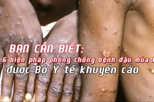 Bạn cần biết: 6 biện pháp phòng chống bệnh đậu mùa khỉ được Bộ Y tế khuyến cáo