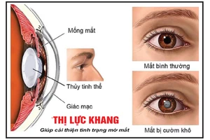 Các bệnh về mắt