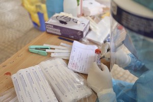 Samples for Covid-19 testing (Photo: VNA)