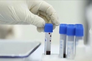 Taking samples for Covid-19 testing (Photo: VNA)