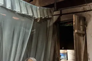 Người mẹ nghèo 93 tuổi chăm con khuyết tật bị bỏng nặng