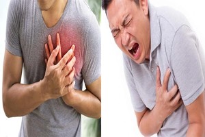 血脂高的５个信号