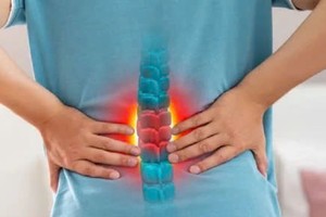 只要注重腰部健康，便能有效地预防腰椎间盘突出的发生。