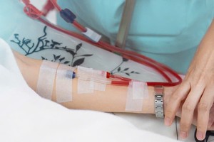 医疗专家肯定，血液透析不适用于防病。