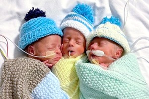 同卵三胞胎麟儿机率仅２亿份之一