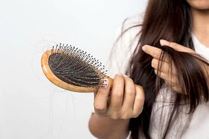 脱发问题令人十分困扰。