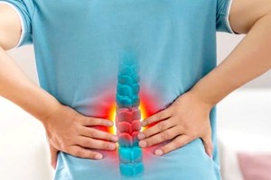 腰痛问题不容小觑。