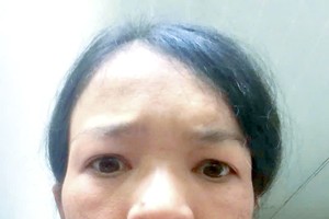 喉癌母亲再度抗癌求援