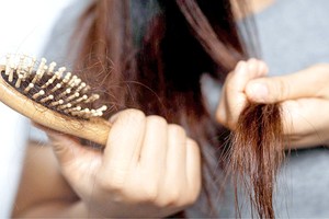 脱发是许多女人的烦恼。