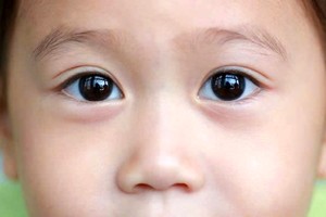 眼睛不仅是心灵的窗户，更是反映全身健康的晴雨表。