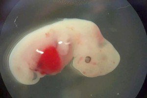 科学家成功培育出人猪嵌合心脏