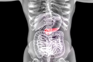 糖尿病患者的福音来了：3D列印成功制造功能性人类胰岛