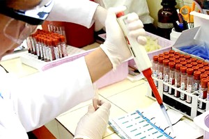 全球爱滋病防治面临资金断崖危机