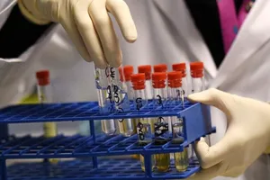 Ngày 15-9 sẽ có kết quả kiểm tra doping của SEA Games 29.