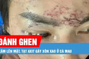 Podcast bản tin tối 8-5: Khởi tố vụ đánh ghen xăm lên mặt, tạt axit gây xôn xao ở Cà Mau