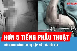 Hồi sinh cánh tay đứt lìa, dập nát do tai nạn lao động