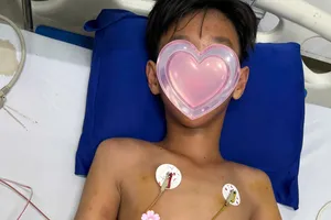 Cà Mau: Cứu sống bé trai đi rừng bị ong vò vẽ đốt hơn 50 vết 