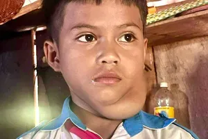 Cậu bé Cadong tự ti với khối u ở cổ